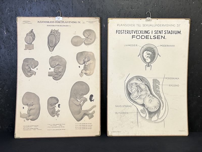 Skolplanscher sexualundervisning IV och människans fortplantning